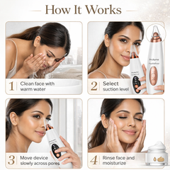 PoreRefiner 6-in-1 Electric Blackhead Remover
