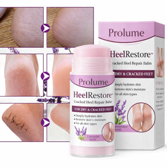 HeelRestore Cracked Heel Repair Balm