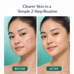 ClearPulse Acne Repair Duo
