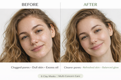 ClayFix Multi-Concern Mask Kit