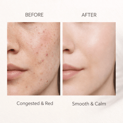Calmora Cica 2-Step Gel Mask