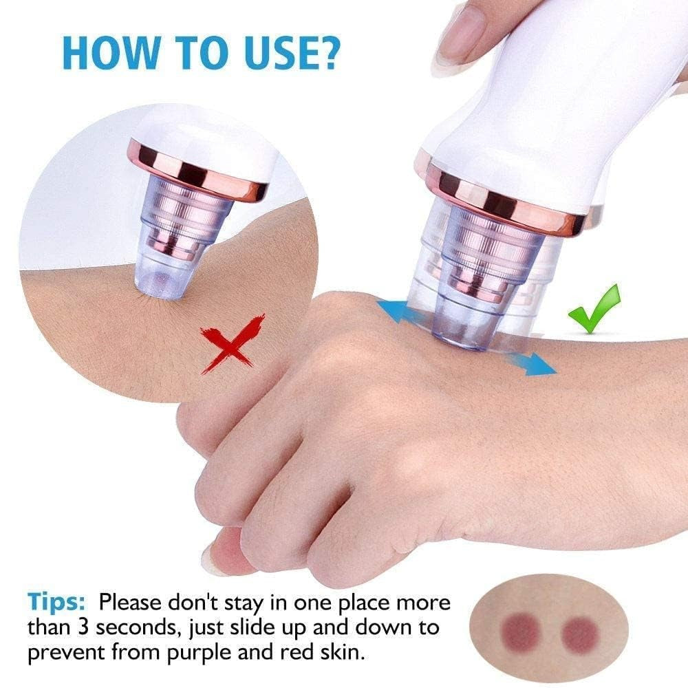 PoreRefiner 6-in-1 Electric Blackhead Remover