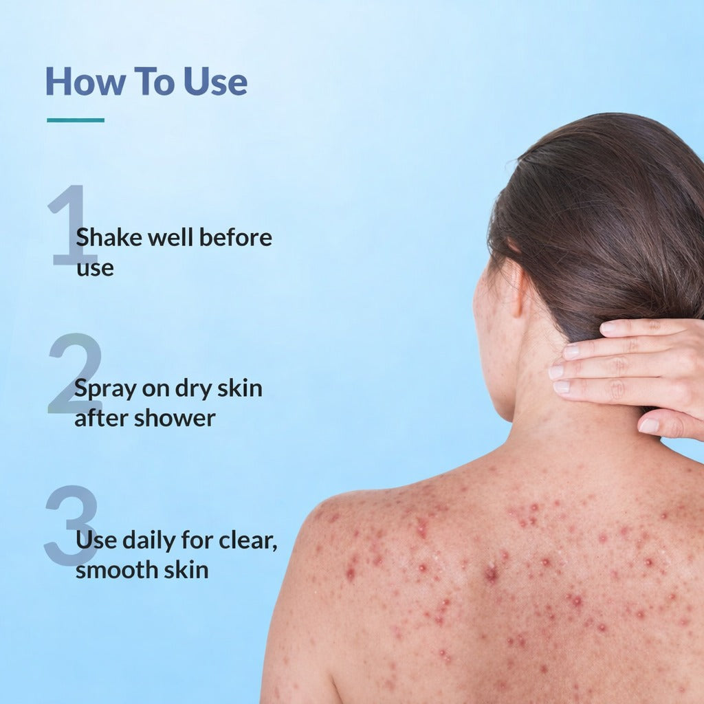BodyAcne Warrior - Acne Control Spray  For Acne on Back, Shoulders & Neck
