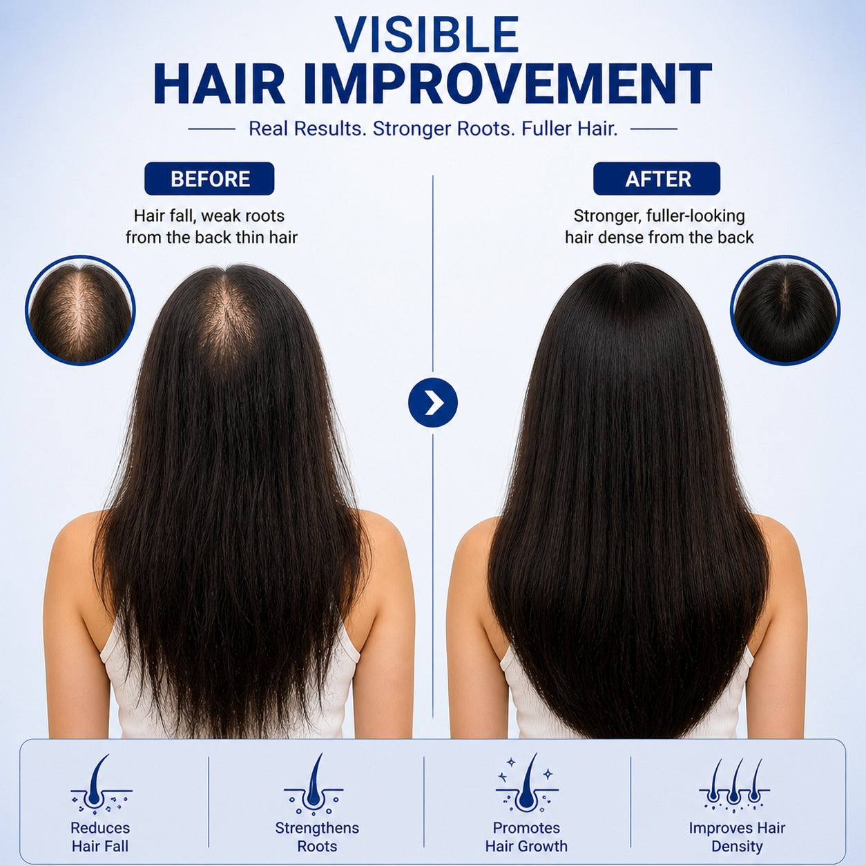 HairStruct Advanced Hair Growth Roll-On Serum With 3% Redensyl + 2% Anagain and Rosemary extract