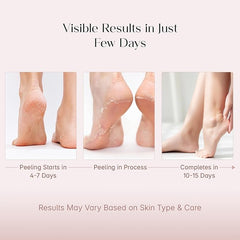 SoftPeel Glycolic Acid Foot Peeling Mask (Pack of 2)
