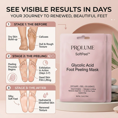 SoftPeel Glycolic Acid Foot Peeling Mask (Pack of 2)