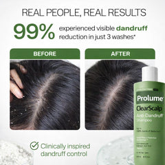 ClearScalp Anti-Dandruff Shampoo