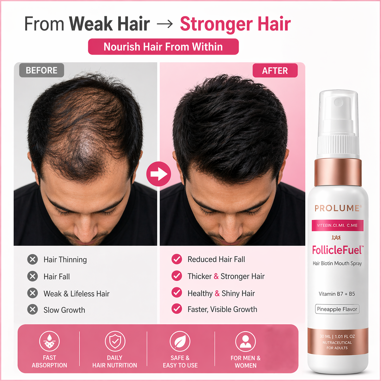 FollicleFuel Hair Biotin Mouth Spray for Hair Growth - Pack of 3
