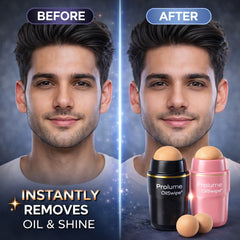OilSwipe Volcanic Roller (Pack of 2)  With FREE 2 Extra Stones