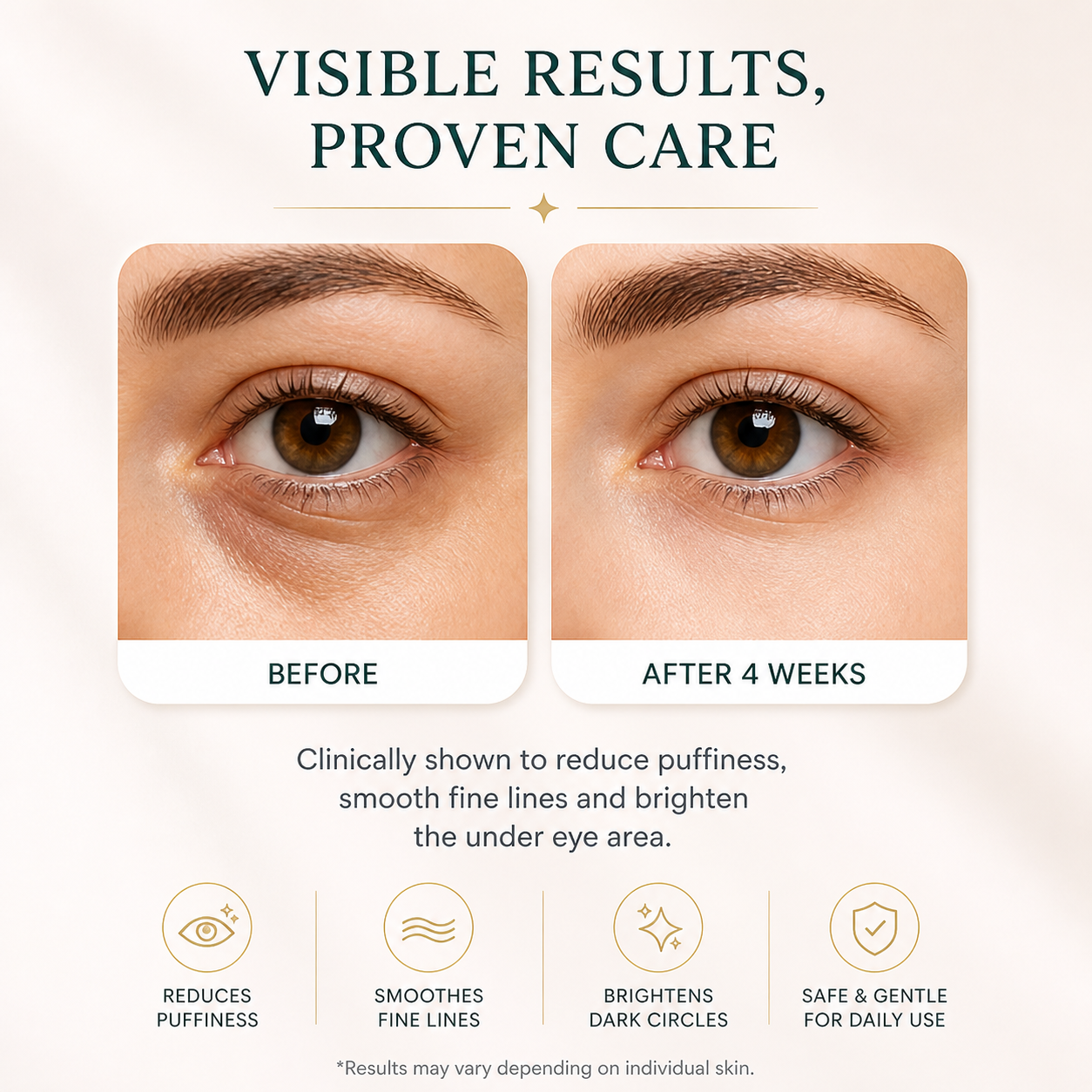 EyeTight Undereye Gel for puffiness and wrinkles