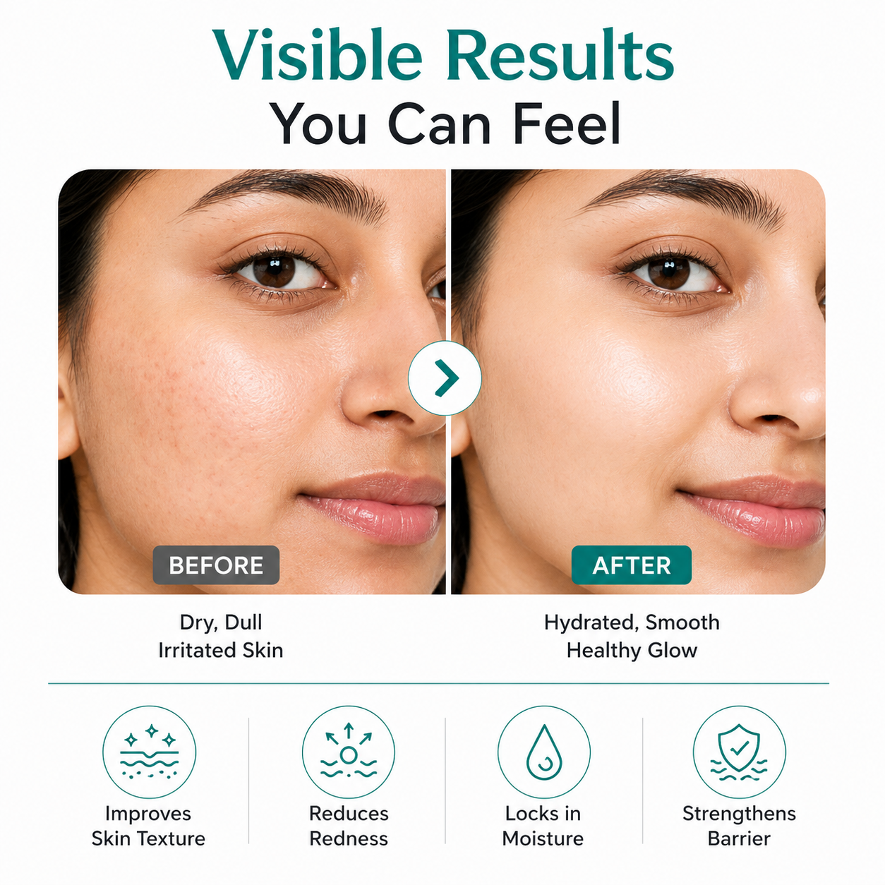 BarrierFix Ceramide Moisturizer Cream