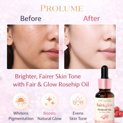 Fair & Glow Rosehip Oil For Face & Skin