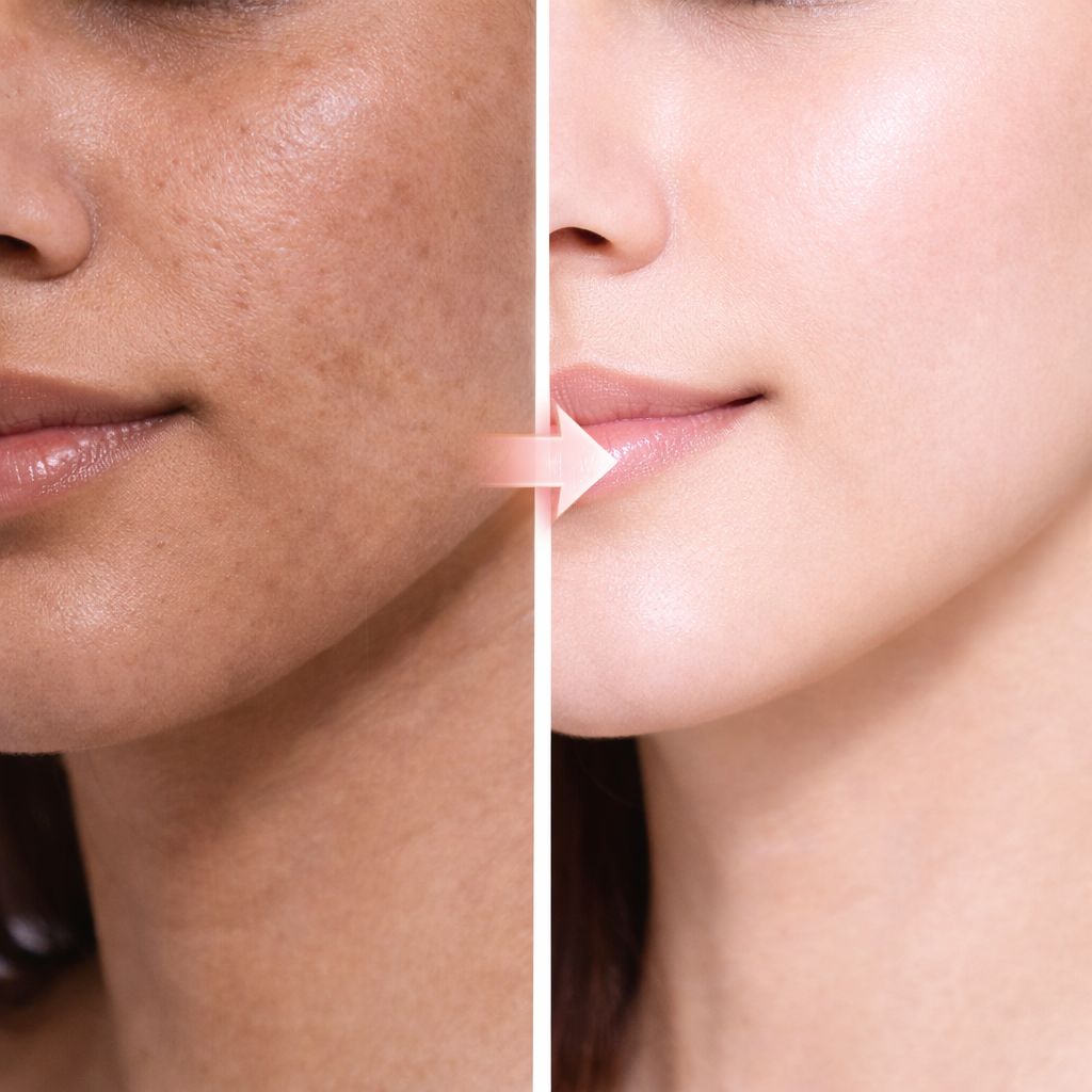 Fair & Glow Rosehip Oil For Face & Skin