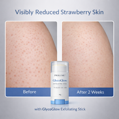 GlycoGlow Exfoliating Stick