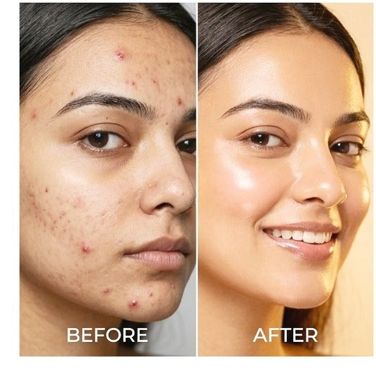Cherry Glow Infusion Mask