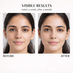 Deep Clean Multani Mitti Face Pack