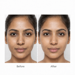 PORE REFINING KIT