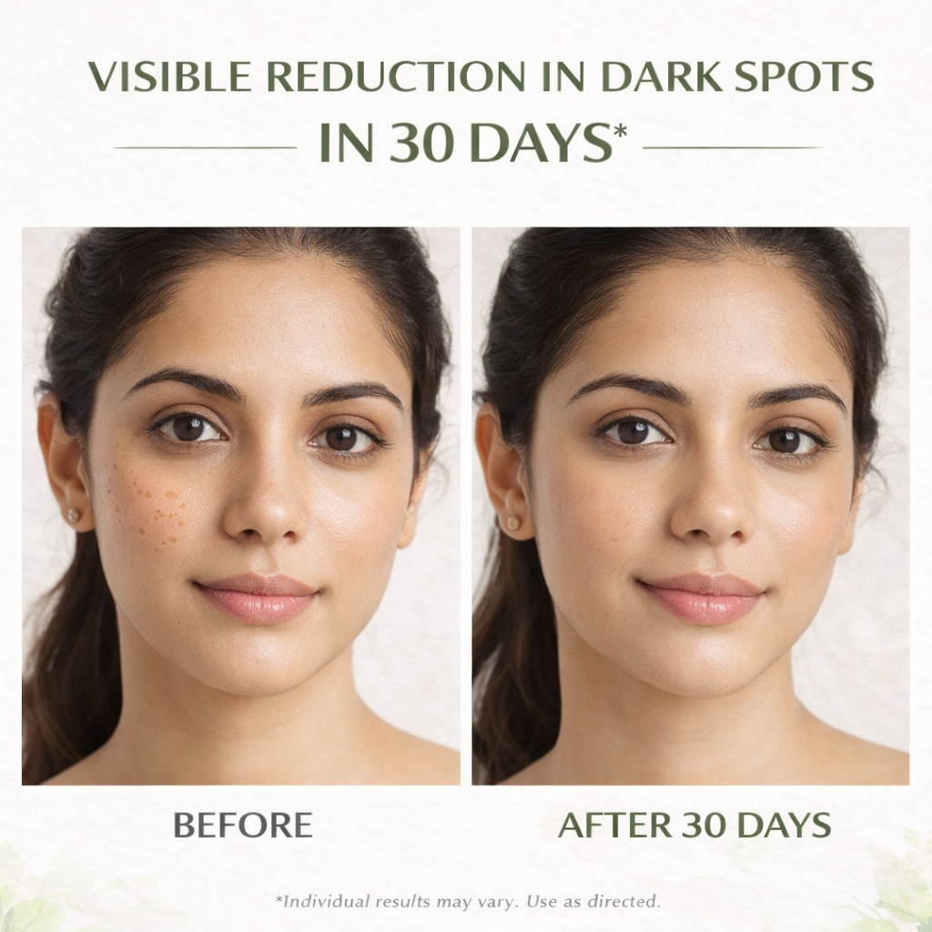 SpotFade Brightening Depigmentation Gel