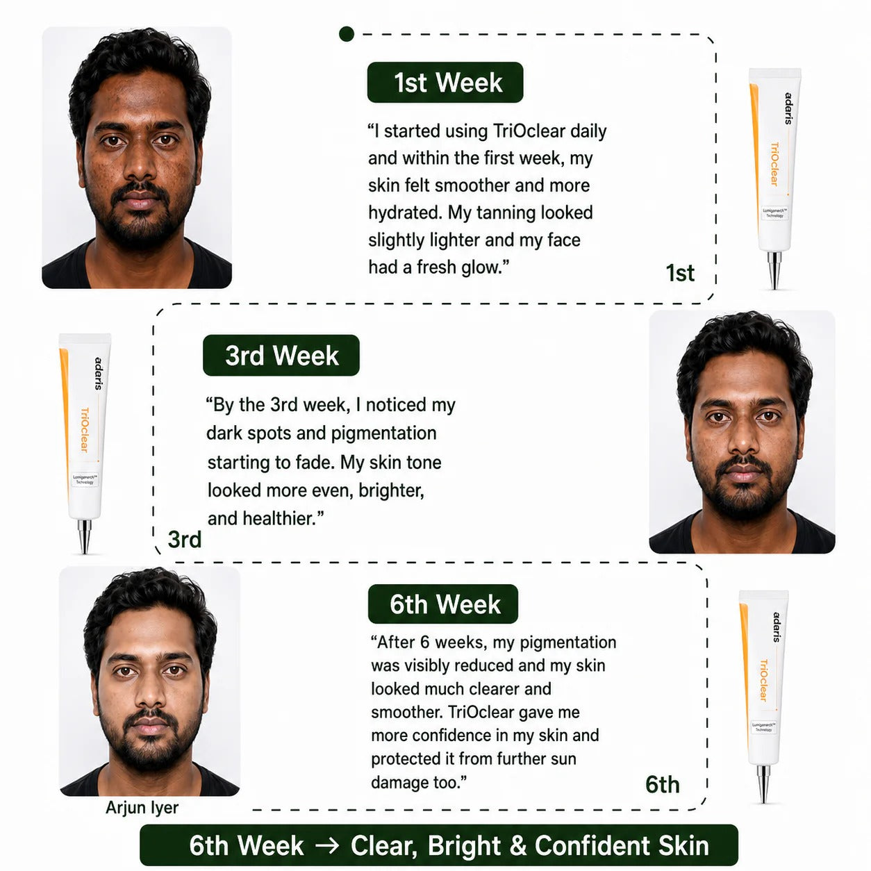 TriOclear Pigmentation Correction Gel