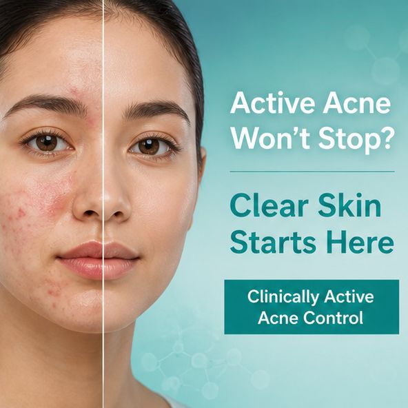 RapidClear Acne Facewash