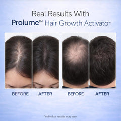 Hair Growth Activator Advanced Multi-Peptide Growth Serum