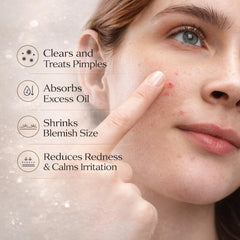 CalmSpot™ 10% Sulfur Powder-to-Cream Blemish Reset