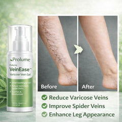 VeinEase™ Varicose Vein Gel